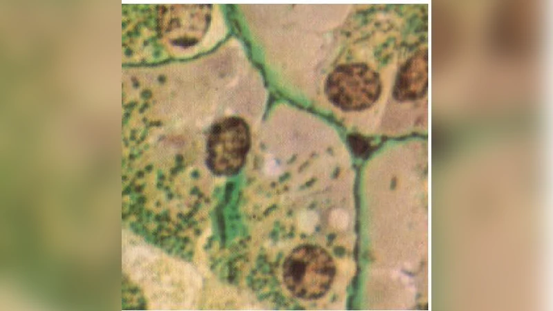 Inverse problems in imaging systems and the general Bayesian inversion   frawework