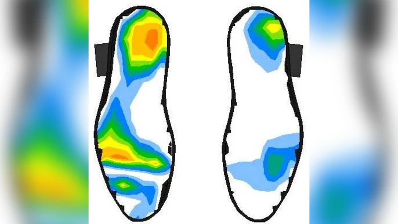 Pressure sensor-based tongue-placed electrotactile biofeedback for   balance improvement - Biomedical application to prevent pressure sores   formation and falls