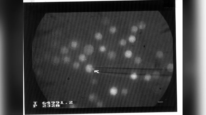 Mechanical deformation of monocytic THP-1 cells : occurrence of two   seqential phases with differential sensitivity to metabolic inhibitors