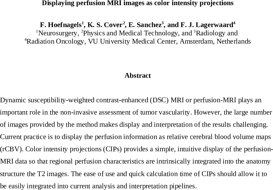 Displaying perfusion MRI images as color intensity projections