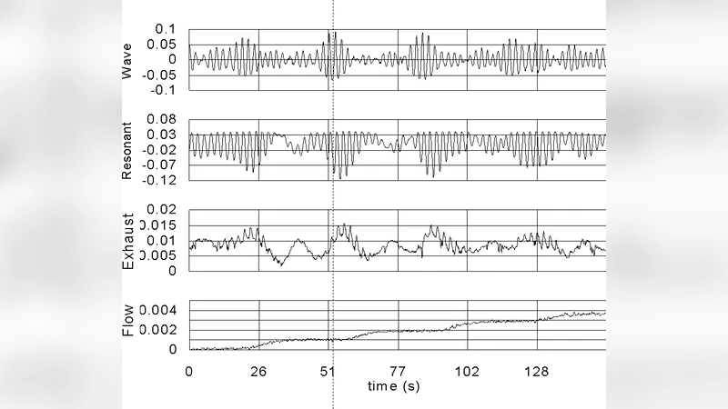 Quantales of open groupoids