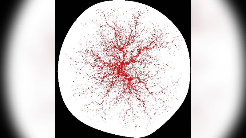 Modeling the variability of shapes of a human placenta