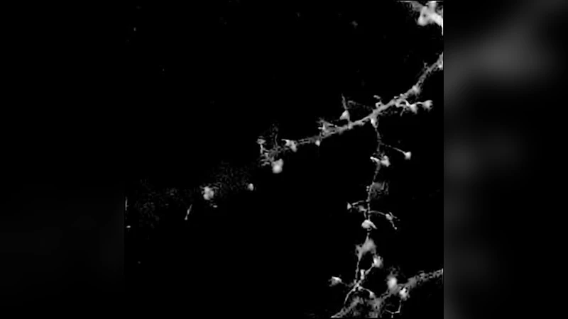 Deconvolution of confocal microscopy images using proximal iteration and   sparse representations