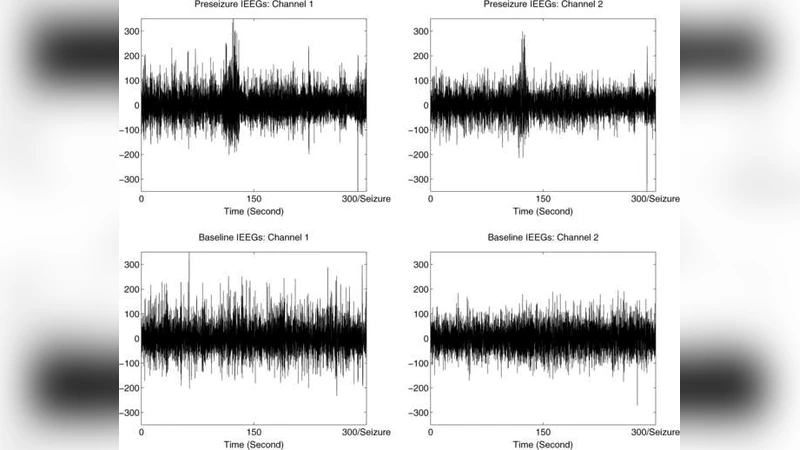 Nonparametric spectral analysis with applications to seizure   characterization using EEG time series
