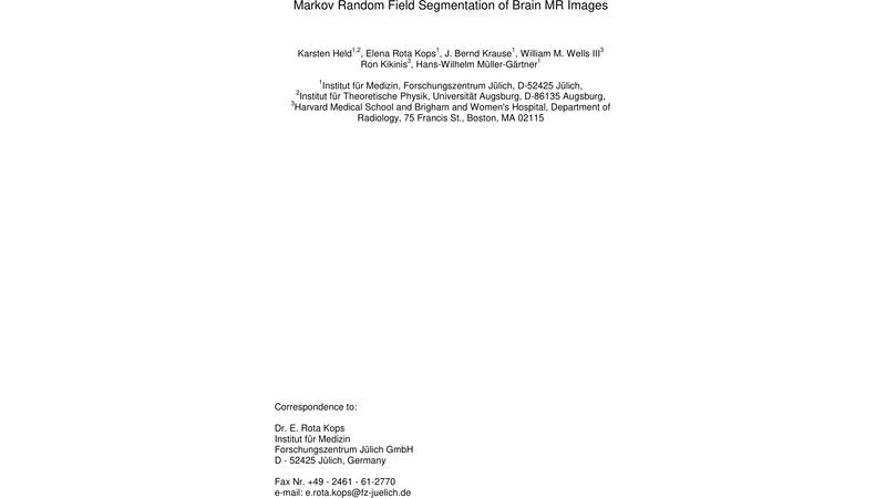 Markov Random Field Segmentation of Brain MR Images