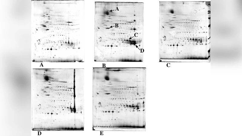 Detergents and chaotropes for protein solubilization before   two-dimensional electrophoresis