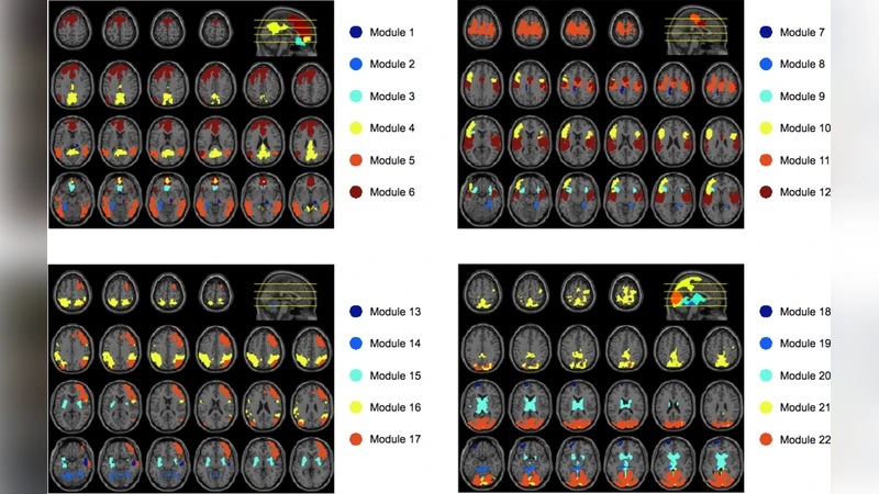 Modular organization as a basis for the functional   integration/segregation in large-scale brain networks