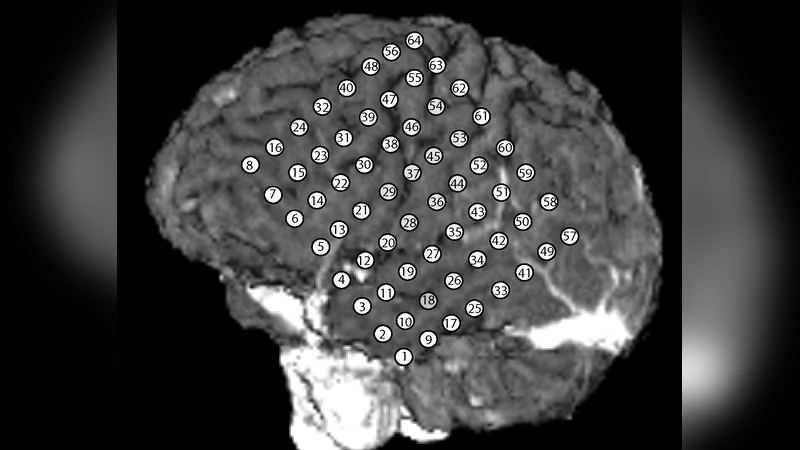 A multivariate phase distribution and its estimation