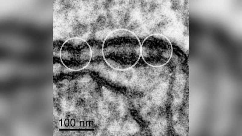 A model for the generation of localized transient Na+ elevations in   vascular smooth muscle