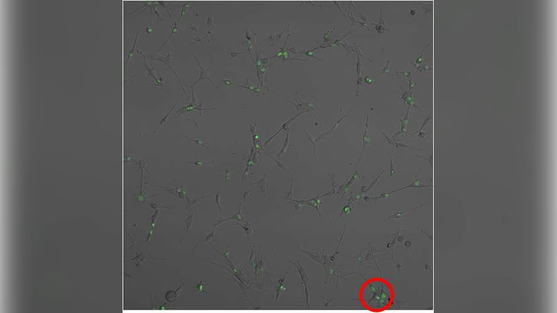 Pattern Formation of Glioma Cells: Effects of Adhesion