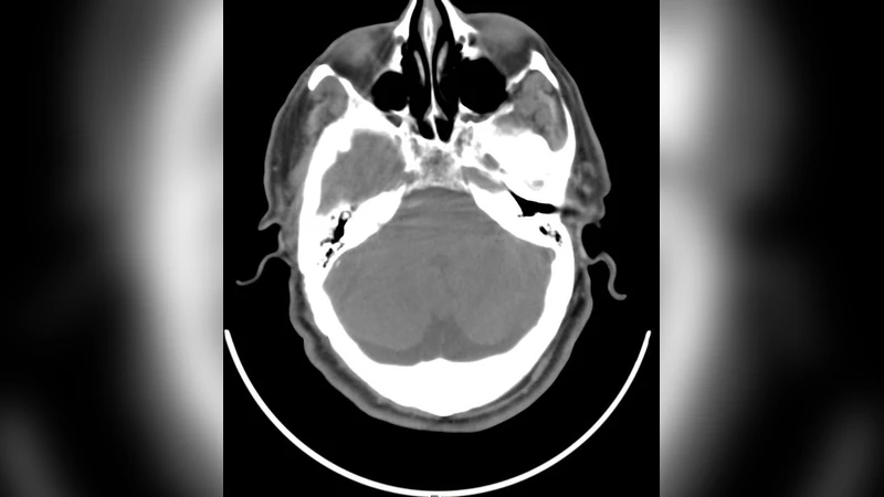 Maximizing Strength of Digital Watermarks using Fuzzy Logic
