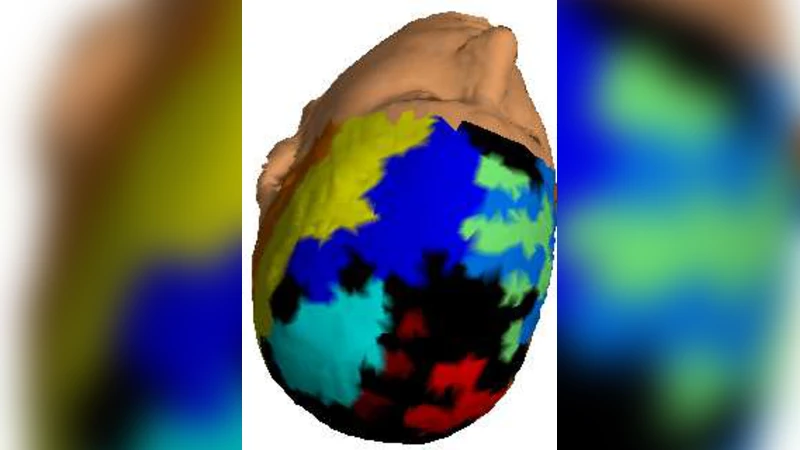 Functional modularity of background activities in normal and epileptic   brain networks