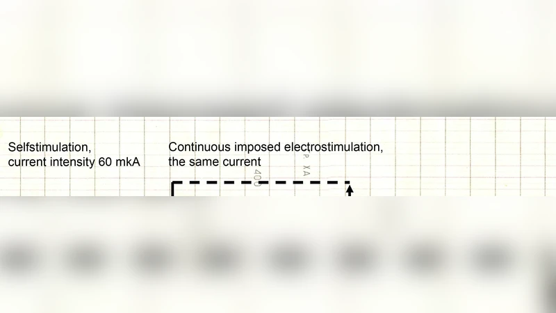 About the Neuronal Mechanism of Lateral Hypothalamic Self-Stimulation   Response
