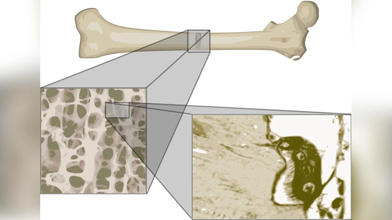 Multiple verification in computational modeling of bone pathologies