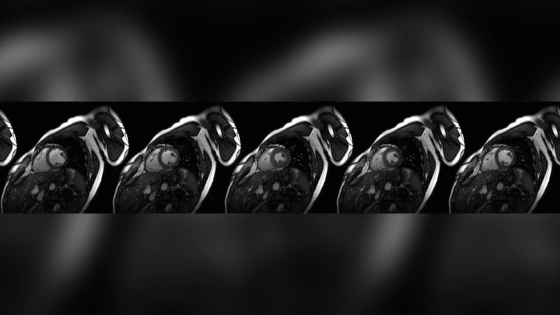Compressed Sensing for Moving Imagery in Medical Imaging