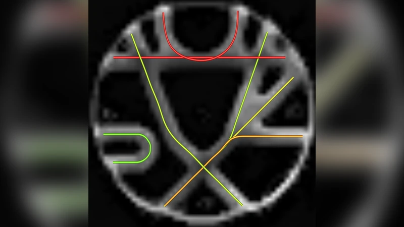 Local Water Diffusion Phenomenon Clustering From High Angular Resolution   Diffusion Imaging (HARDI)