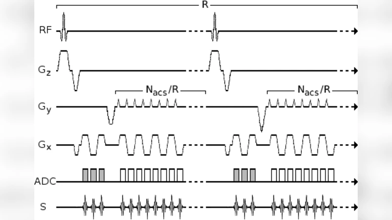 Simultaneous Reduction of Two Common Autocalibration Errors in GRAPPA   EPI Time Series Data