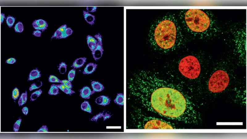 The chaos within: exploring noise in cellular biology
