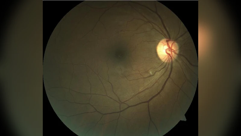 A Session Based Blind Watermarking Technique within the NROI of Retinal   Fundus Images for Authentication Using DWT, Spread Spectrum and Harris Corner   Detection