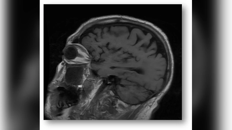 Insertion and Sorting in a Sequence of Numbers Minimizing the Maximum   Sum of a Contiguous Subsequence