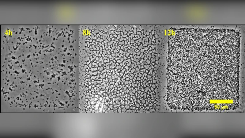 The Swiss cheese instability of bacterial biofilms