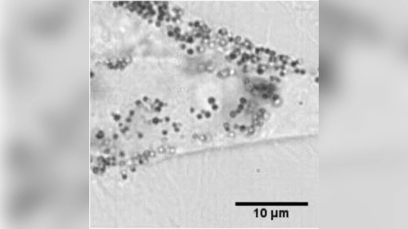 Transition to superdiffusive behavior in intracellular actin-based   transport mediated by molecular motors