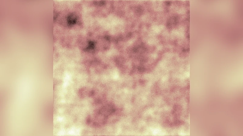 Peak-peak correlations in the cosmic background radiation from cosmic   strings