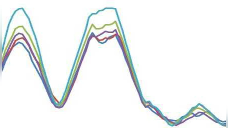 Predictive Modelling of Bone Age through Classification and Regression   of Bone Shapes