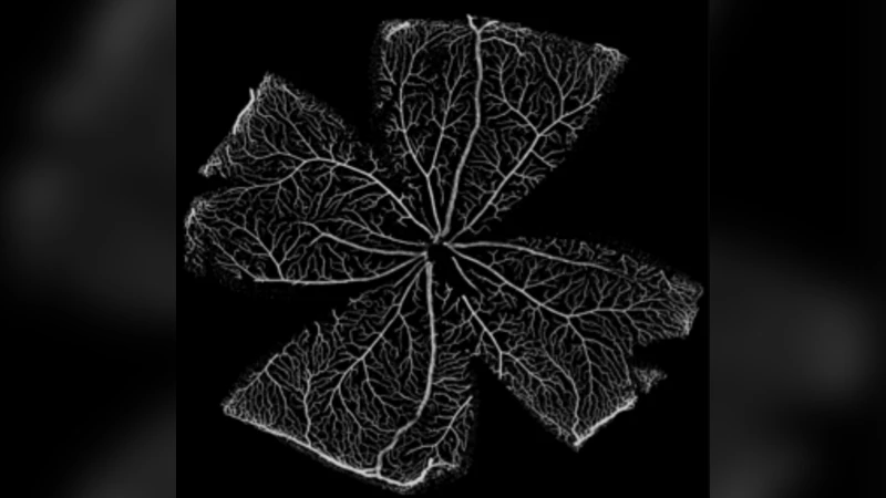 Computer simulations reveal complex distribution of haemodynamic forces   in a mouse retina model of angiogenesis