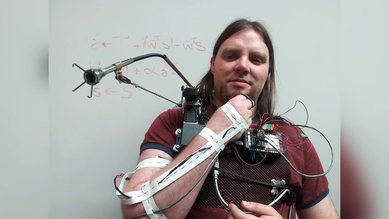 Using Learned Predictions as Feedback to Improve Control and   Communication with an Artificial Limb: Preliminary Findings