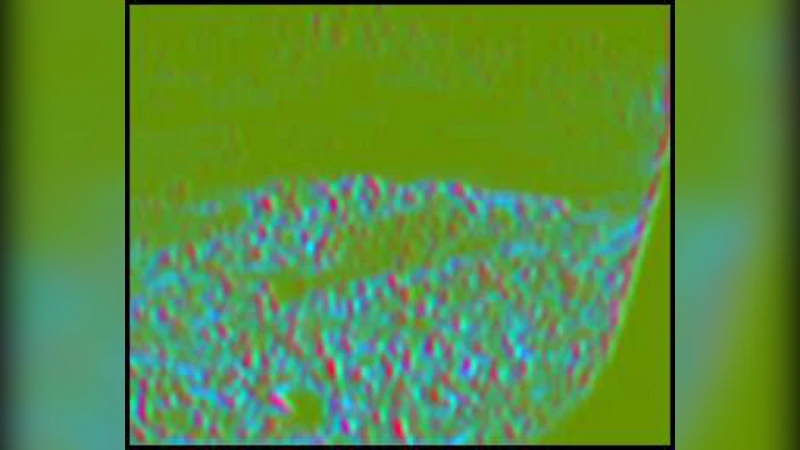 Tensor-SIFT based Earth Movers Distance for Contour Tracking