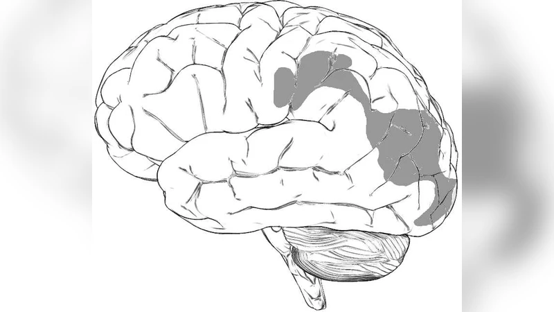 Two-dimensional wave patterns of spreading depolarization: retracting,   re-entrant, and stationary waves