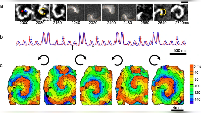 Optical control of waves in a cardiac excitable medium