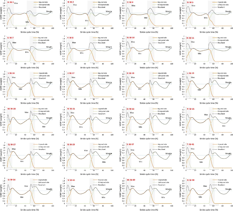 3D elastoplastic simulation of ski-triggered snow slab avalanches
