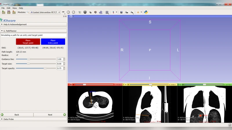 SlicerPET: A workflow based software module for PET/CT guided needle   biopsy