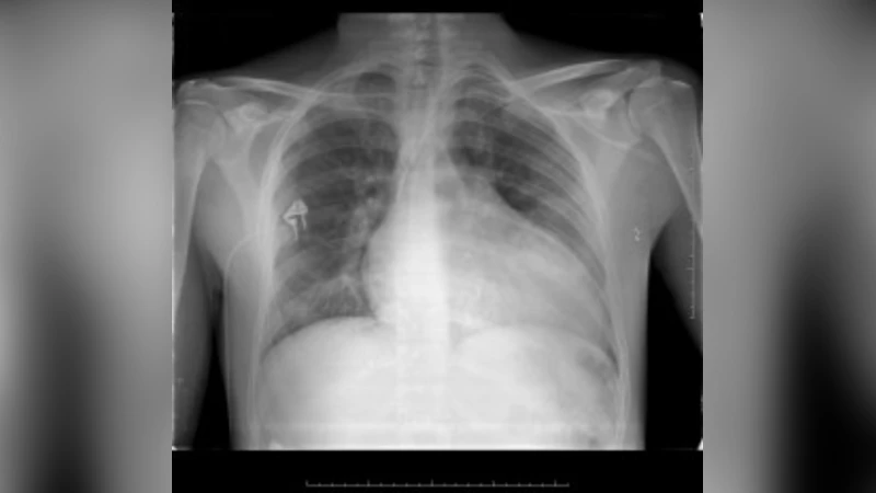 A new Watermarking Technique for Medical Image using Hierarchical   Encryption