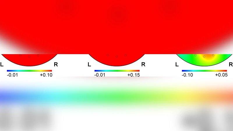 Correlation between amygdala BOLD activity and frontal EEG asymmetry   during real-time fMRI neurofeedback training in patients with depression