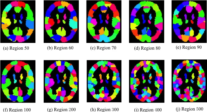 Scalable Algorithms for Generating and Analyzing Structural Brain   Networks with a Varying Number of Nodes
