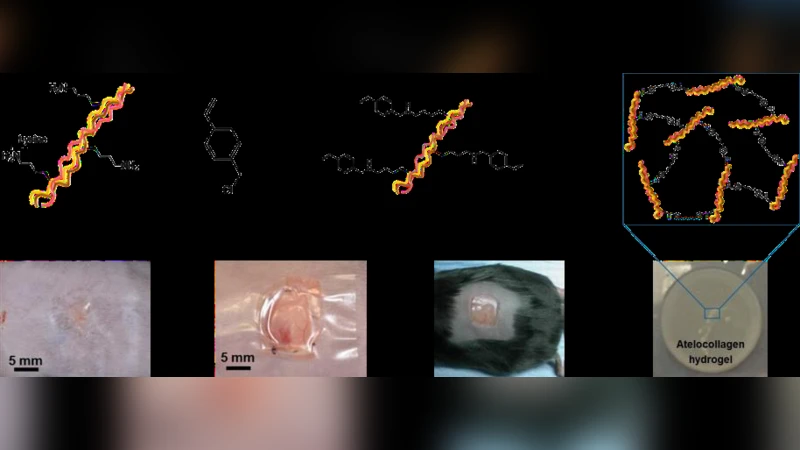 Protease-sensitive atelocollagen hydrogels promote healing in a diabetic   wound model