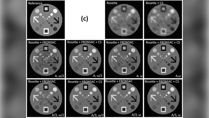 Accelerate Single-shot Data Acquisitions Using Compressed Sensing and   FRONSAC Imaging