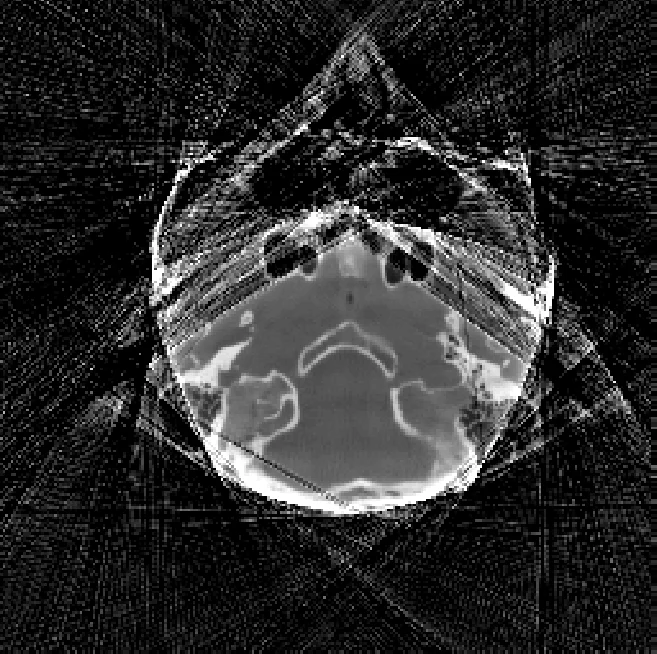 Mixed one-bit compressive sensing with applications to overexposure   correction for CT reconstruction