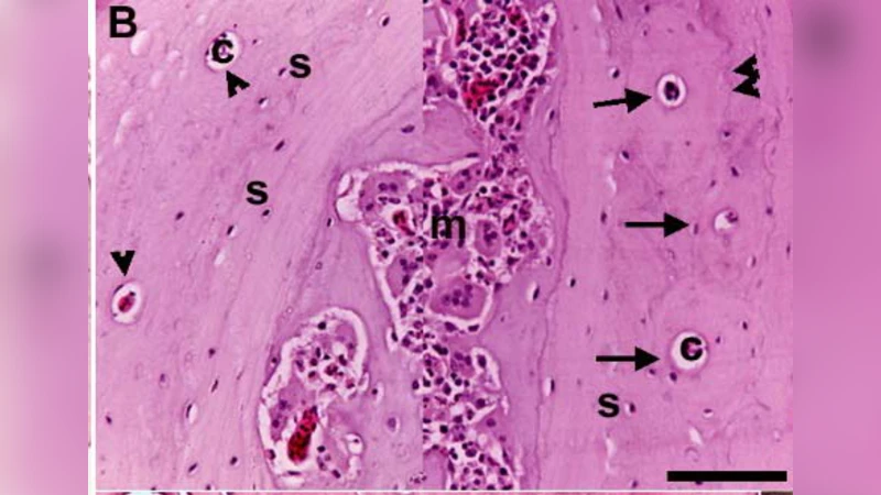 Absence of Typical Haversian System from the Compact Bone of Some   Reptile and Bird Species