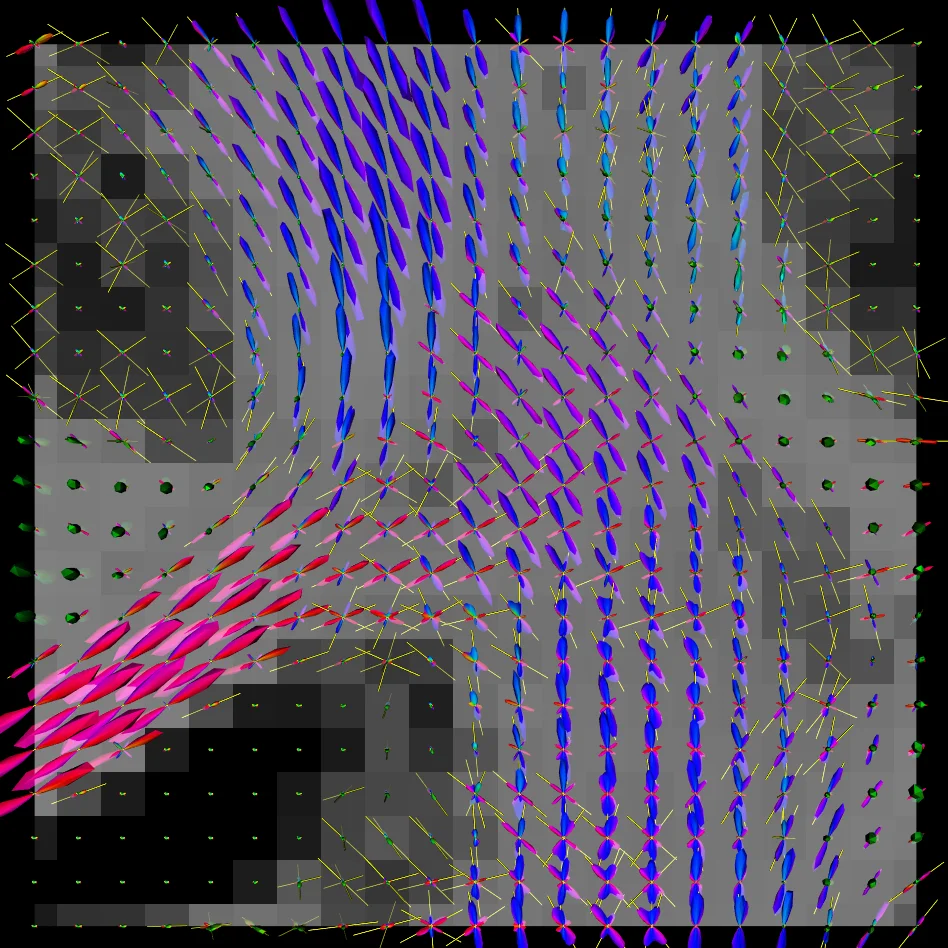 Person-Centric Annotations of LAION-400M: Auditing Bias and Its Transfer to Models
