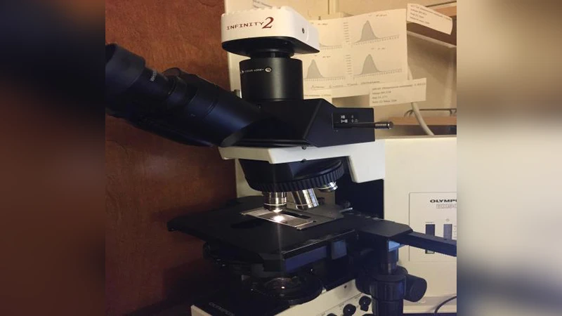 Detection of Cancer Stages via Fractal Dimension Analysis of Optical   Transmission Imaging of Tissue Micro Arrays (TMA)