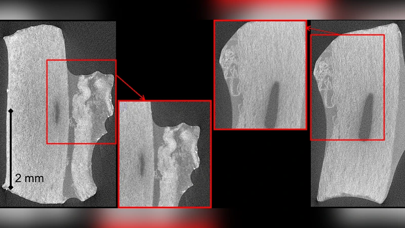 Tensile rupture of medial arterial tissue studied by X-ray   micro-tomography on stained samples