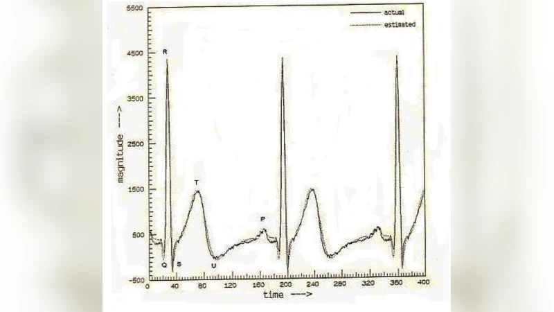 Parametric Modeling of Non-Stationary Signals