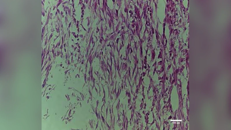 A Novel Model of Cancer-Induced Peripheral Neuropathy and the Role of   TRPA1 in Pain Transduction