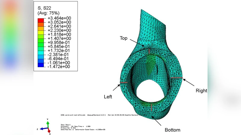 Optimal mechanical operation in the vicinity of curved vasculature