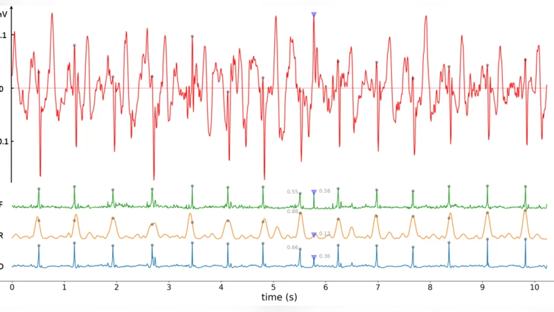 ReNN: Rule-embedded Neural Networks