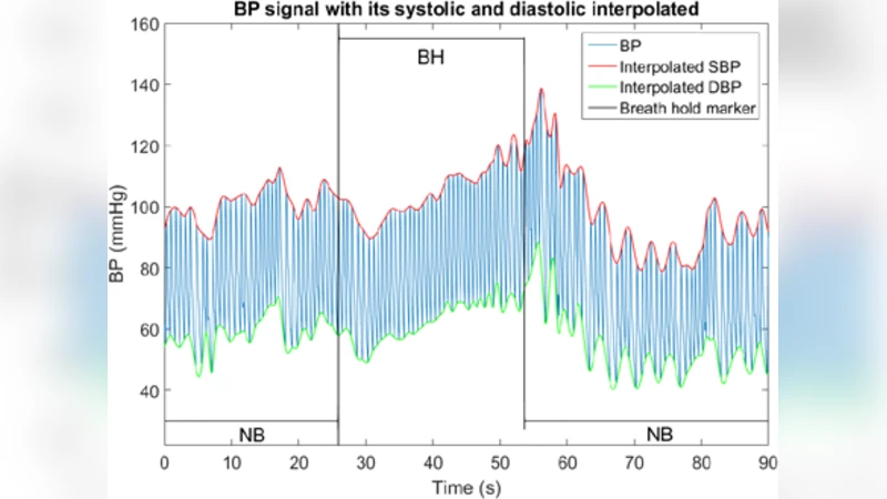 Mathematical Modeling of Arterial Blood Pressure Using   Photo-Plethysmography Signal in Breath-hold Maneuver